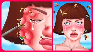 Treatment amp removal of the BEE STINGER stuck in the cute girls face 🐝 Satisfying ASMR Animation [upl. by Acirat]