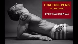 KNOW EVERYTHING ABOUT FRACTURE PENIS AND ITS TREATMENT  BY DR VIJAY DAHIPHALE [upl. by Corsetti]