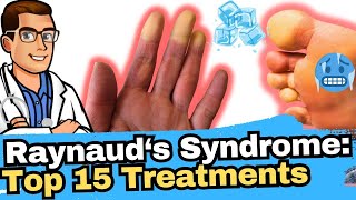 Raynauds Syndrome vs Phenomenon vs Disease Why Are My Toes Cold [upl. by Niala]