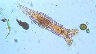 Rotifera Bdelloidea Philodina roseola Anatomical focus [upl. by Julio]