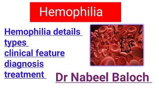 Hemophilia details lectures  Hematology [upl. by Vinson929]