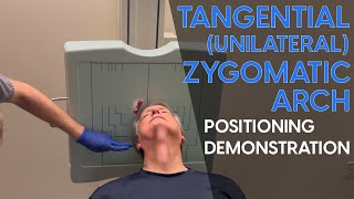 Tangential Unilateral Zygomatic Arch Radiographic Positioning Demonstration [upl. by Eiramyma]