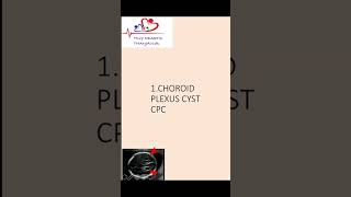 Choroid plexus cyst  Antenatal scan  Downs syndrome choroidplexuscyst [upl. by Dorkus]