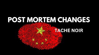 POST MORTEM CHANGES TACHE NOIRforeniscmedicine [upl. by Esirehs]