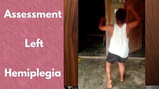 Assessment  Gait  Hemiplegia  Short Video  DrKhaqan [upl. by Galitea]