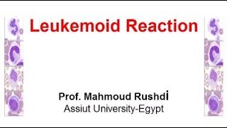 Leukemoid Reaction Arabic 2017 [upl. by Lysander]