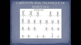 Copie de 2020 06 18 15 cours caryotype 32 [upl. by Anet]