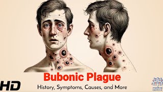 Bubonic Plague The Black Death [upl. by Intyrb]