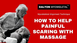 How to Help Painful Scarring with Massage [upl. by Ehrlich]