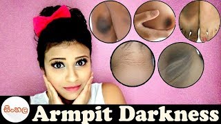 Armpit Darkness Sinhala Srilankan [upl. by Sikram]