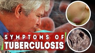 What is tuberculosis  symptoms of TB in all types and stages [upl. by Legra]