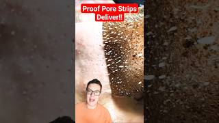 PROOF PORE STRIPS WORK  Phenomenal Pore Strip Removal shorts [upl. by Wynny287]