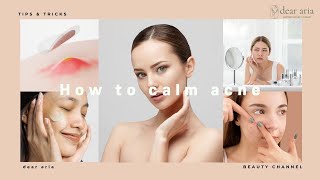 How to calm acne [upl. by Ecirahs]