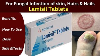 Lamisil tablets how to use  Terbinafine  toenail fungus  Fungal infection best medicine [upl. by Ellehcir523]