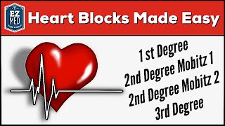 AV Heart Blocks Made Easy  1st 2nd 3rd Degree ECG Interpretation Explained [upl. by Akkahs]