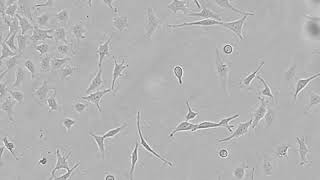 Teaching cell biology with livecell imaging contamination in a HeLa cell culture  CytoSMART Lux2 [upl. by Aeneus977]