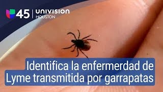 Aprende a identificar los síntomas de la enfermedad de Lyme transmitida por las garrapatas [upl. by Cohbath]