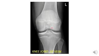 Radiological Anatomy of Lower Limb [upl. by Hgielak]