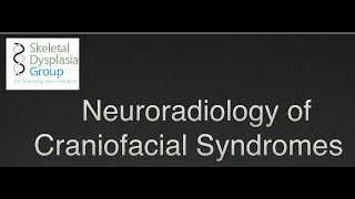 Neuroradiology of Craniofacial Syndromes craniosynostosis and beyond [upl. by Enram]