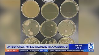 Antibioticresistant super bacteria found for the first time in Los Angeles County [upl. by Boyden913]