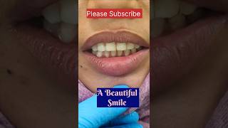 Dental Braces gives A Beautiful Smile teeth trending mydentist [upl. by Montagu]