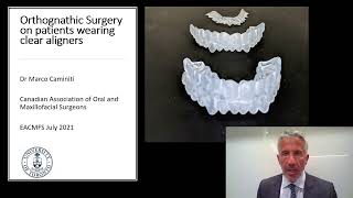 Orthognathic Surgery with Clear Aligners EACMFS July 2021 Dr M Caminiti [upl. by Aitahs15]