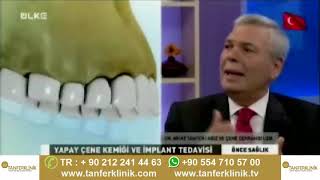 implant nedir  Çene Kemiği erimesinde implant yapılır mi TanferKlinik [upl. by Deb172]