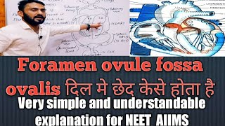 Foramen ovale l fossa ovalis l congenital heart disease l circulatory system l NEET AIIMS [upl. by Adnalor]