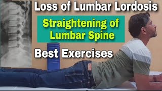 Loss of Lumbar Lordosis Exercises in Hindi  Straightening of Lumbar Spine  Spine Curvature [upl. by Ahterod]