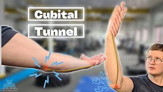 The BEST Exercises For Cubital Tunnel Syndrome [upl. by Mountfort]