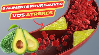 5 aliments pour sauver vos artères  maladie cardiaque  crise cardiaque  cardiac catheterization [upl. by Yelrac]