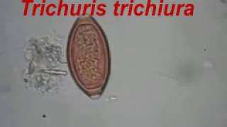 Trichuris trichiura and Ascaris lumbricoides [upl. by Mansur]