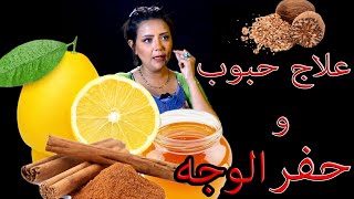 وصفه لعلاج حبوب و بقع و حفر الوجه بمواد طبيعيه [upl. by Aneeled]