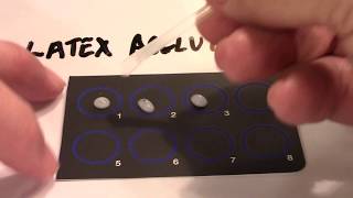 Latex Agglutination and Titer  Part 1 [upl. by Ziwot391]