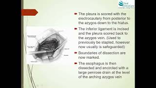 Open Ivor Lewis Esophagectomy  Surgical Steps [upl. by Aro]