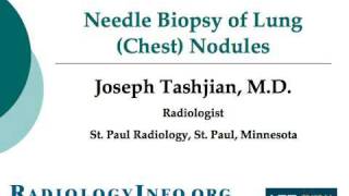 Your Radiologist Explains Needle Biopsy of Lung Chest Nodules [upl. by Marmaduke889]