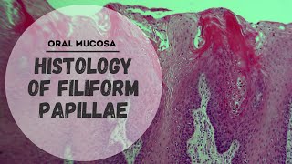 Histology of Specialized Mucosa  Filiform papillae [upl. by Trilby]