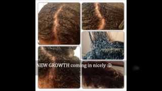 My Natural Hair Journey TEXTURIZER to NATURAL [upl. by Sherrer]