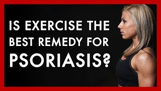 Is exercise the best remedy for psoriasis [upl. by Randell]