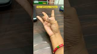 Varun mudra helps to maintain heemoglobin  hormonal changes and RBC WBC count mudratherapy yt [upl. by Small]