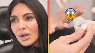 Kim Kardashian Shares GRUESOME FingerSlicing Accident [upl. by Eniamrej516]