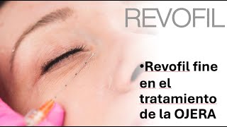 Como abordar las OJERAS con REVOFIL FINE [upl. by Navlys]