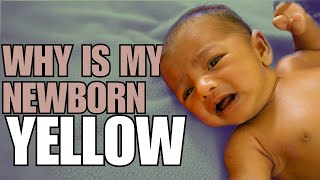 Newborn Jaundice Causes Symptoms and Treatment [upl. by Gluck273]