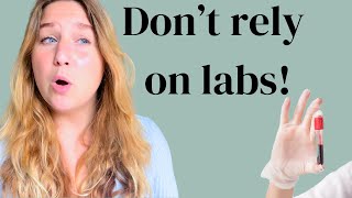 ❗️Don’t believe Labs in EDs and recovery [upl. by Enwad]