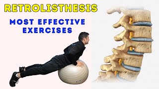 Retrolisthesis Exercises for Stronger Core [upl. by Latona396]