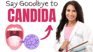 Say Goodbye to Candida  How To Get Rid Of Candida For Good  Dr Taz [upl. by Jerz]