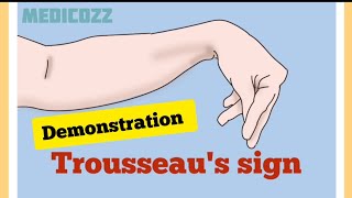 Trousseaus sign in Hypocalcemia  Patient video  causes treatment prevention [upl. by Damour]