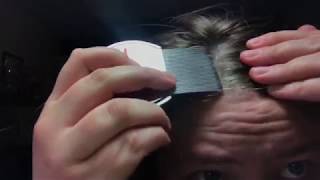 FIRST TIME SCRAPING SCALP USING LICE COMB  battling scalp psoriasis and extreme dandruff [upl. by Atteloc720]