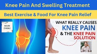 Knee pain and swelling  Knee Pain causes symptoms diagnosis and treatment  AasanZindagi [upl. by Rodger346]