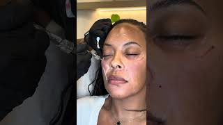 Natural Results Live Here fillersarelife skincare [upl. by Brockie]